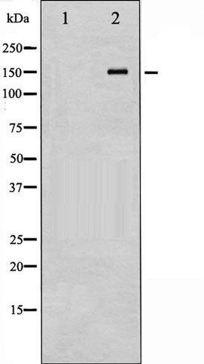 Phospho-eNOS (Thr494) Antibody in Western Blot (WB)