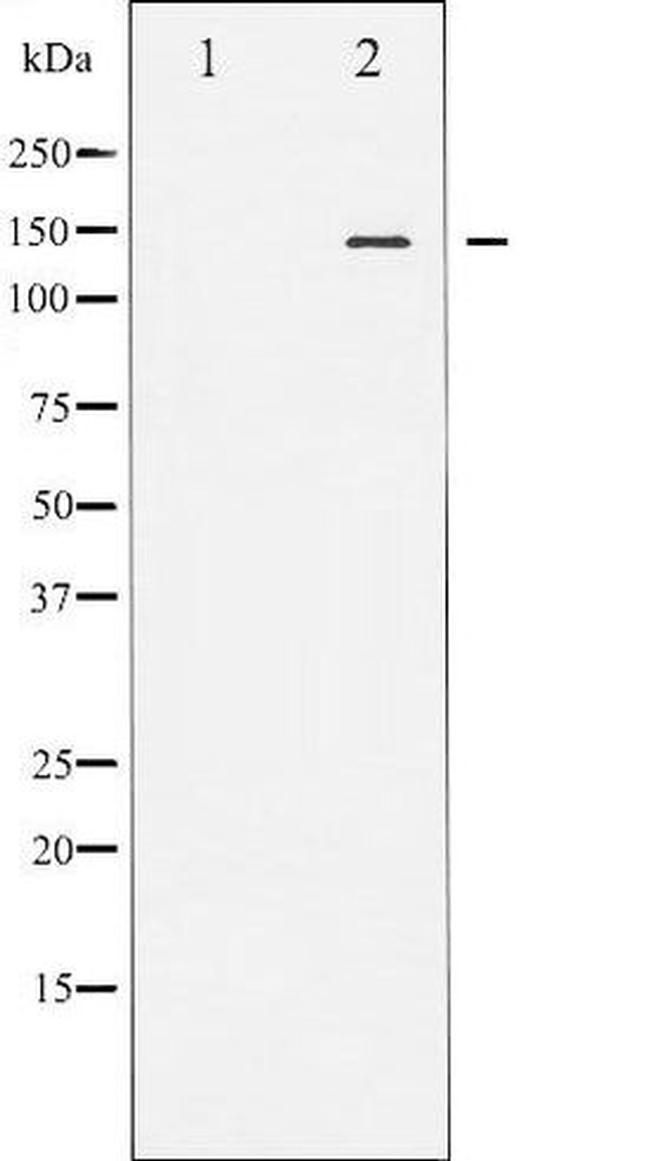 Phospho-eNOS (Ser1176) Antibody in Western Blot (WB)