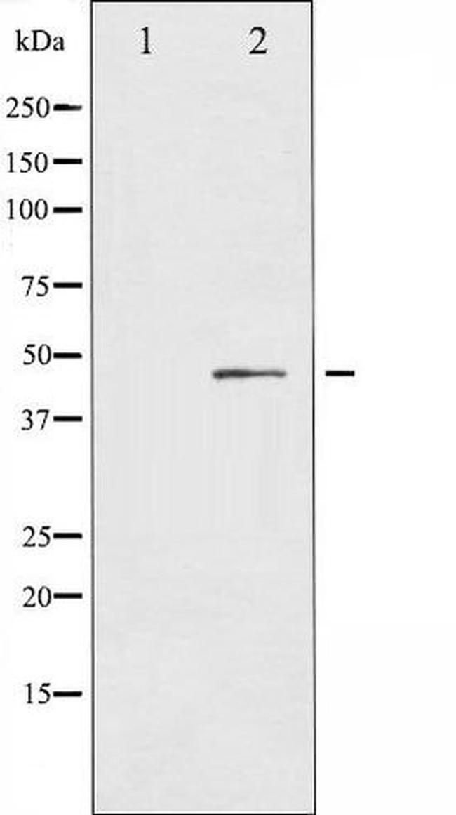 Phospho-IL-8R beta / CXCR2 (Ser347) Antibody in Western Blot (WB)