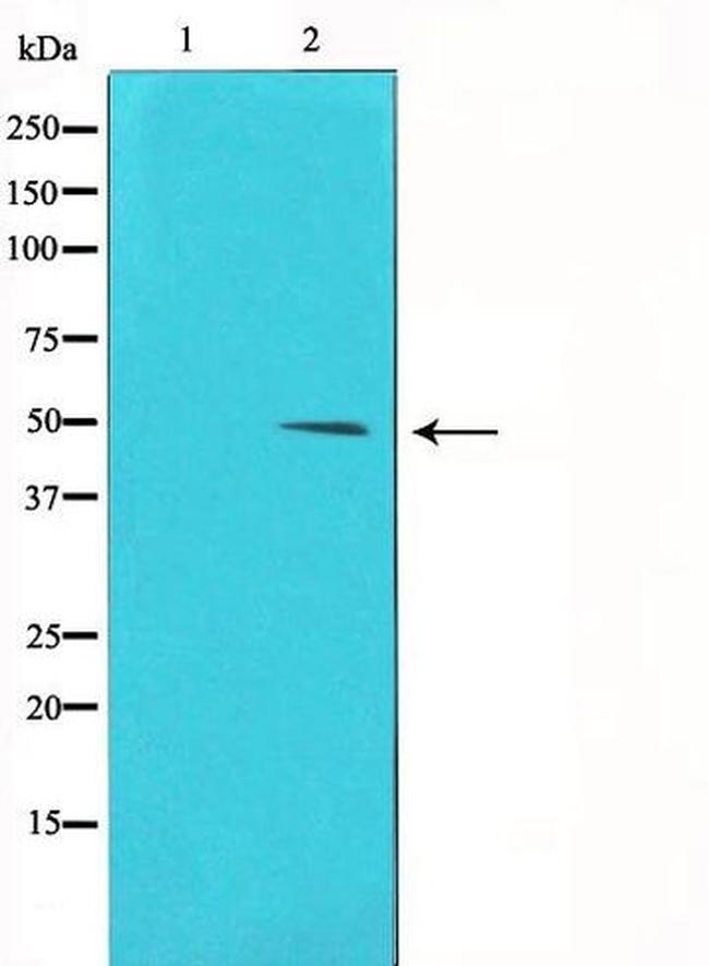 Phospho-Cyclin E1 (Thr395) Antibody in Western Blot (WB)