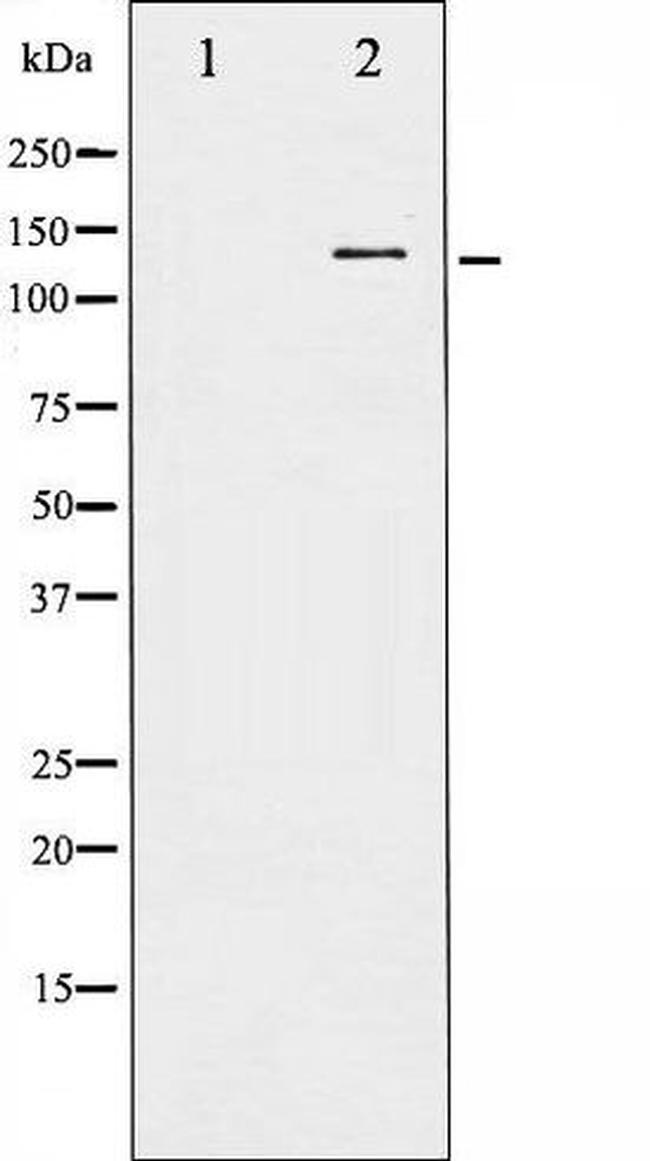 Phospho-Cbl (Tyr674) Antibody in Western Blot (WB)