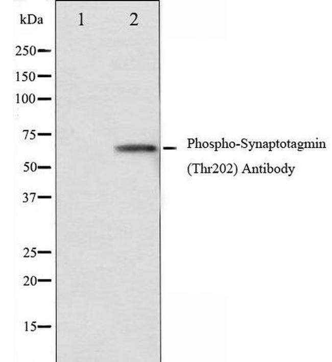 Phospho-Synaptotagmin 1 (Thr202) Antibody in Western Blot (WB)