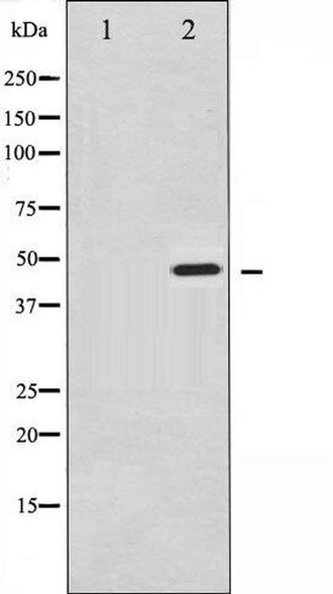 Phospho-Synaptotagmin 1 (Ser309) Antibody in Western Blot (WB)