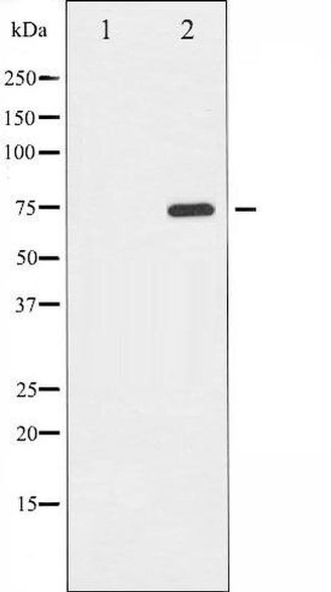 Phospho-PKR/PRKR (Thr446) Antibody in Western Blot (WB)