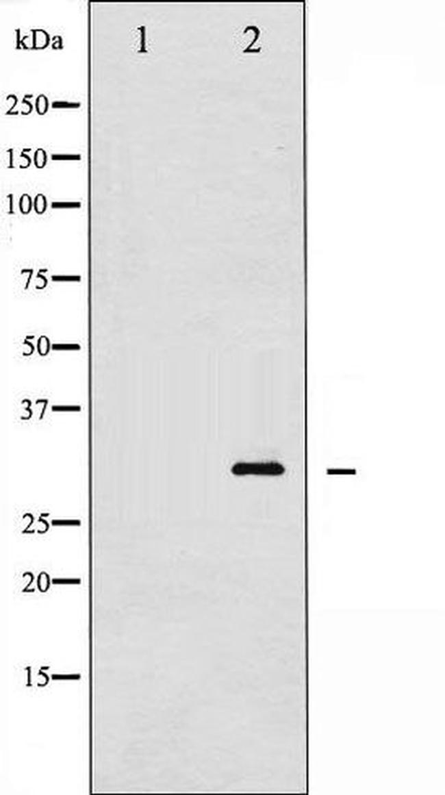 Phospho-Cardiac Troponin I (Thr142) Antibody in Western Blot (WB)