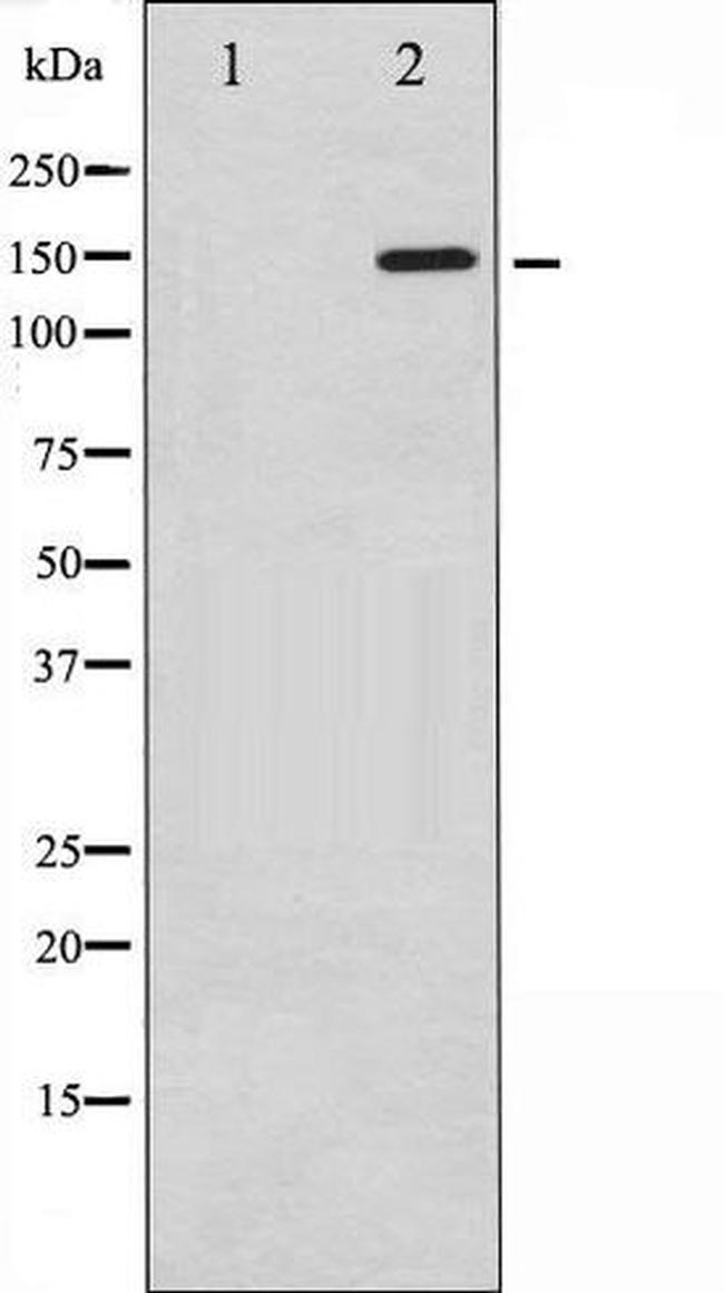 Phospho-PLCG1 (Tyr771) Antibody in Western Blot (WB)