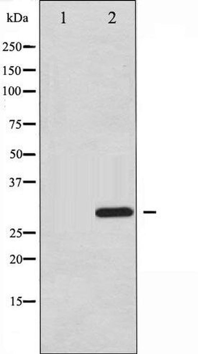 Phospho-ATF1 (Ser63) Antibody in Western Blot (WB)
