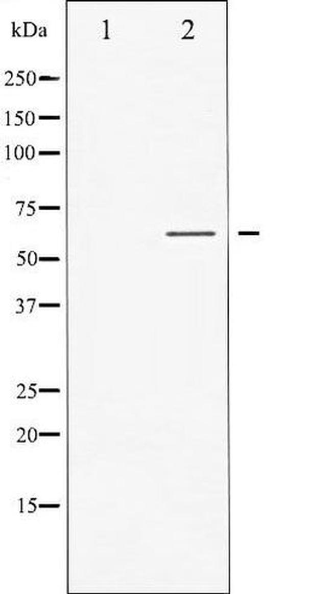Phospho-GABA-A Receptor beta-1 (Ser434) Antibody in Western Blot (WB)