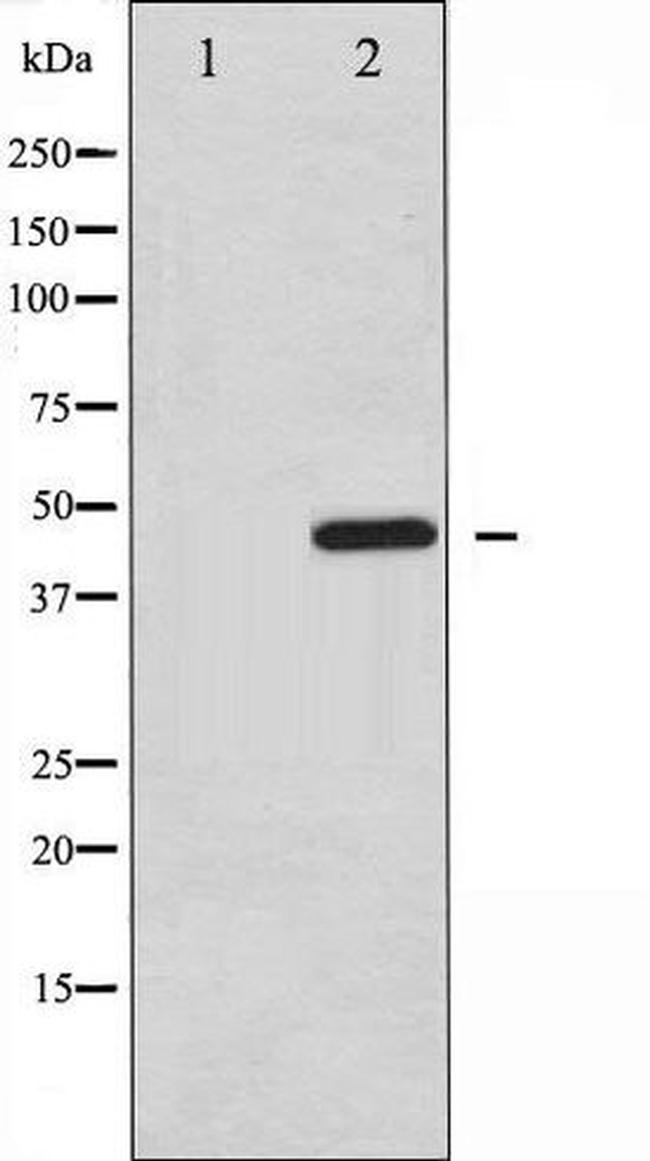 Phospho-PTP1B / PTPN1 (Ser50) Antibody in Western Blot (WB)