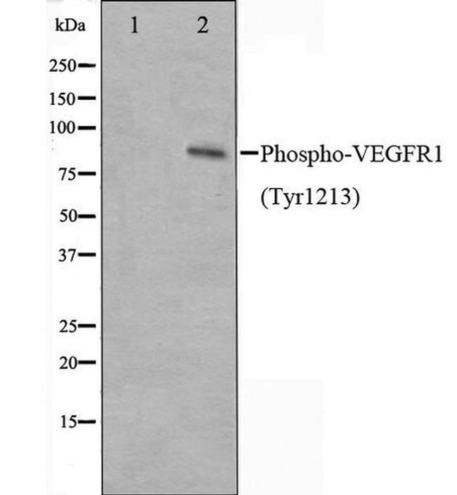 Phospho-VEGF Receptor 1 (Tyr1213) Antibody in Western Blot (WB)