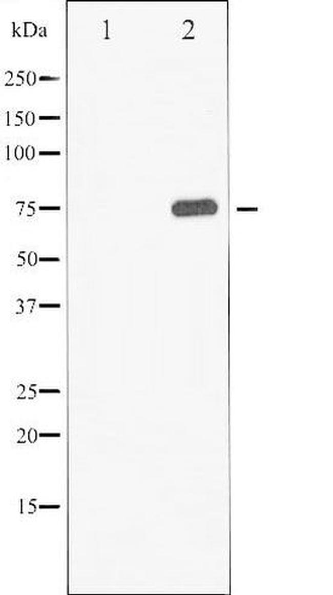 Phospho-Synapsin 1 (Ser9) Antibody in Western Blot (WB)
