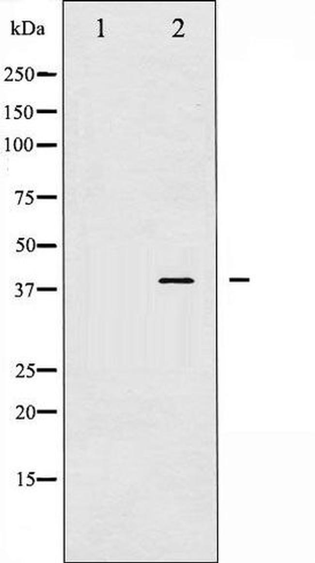 Phospho-JunD (Ser255) Antibody in Western Blot (WB)