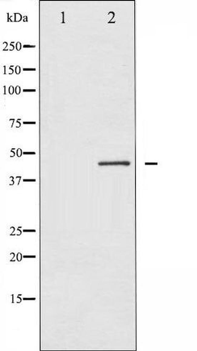 Phospho-Connexin 43 (Ser367) Antibody in Western Blot (WB)