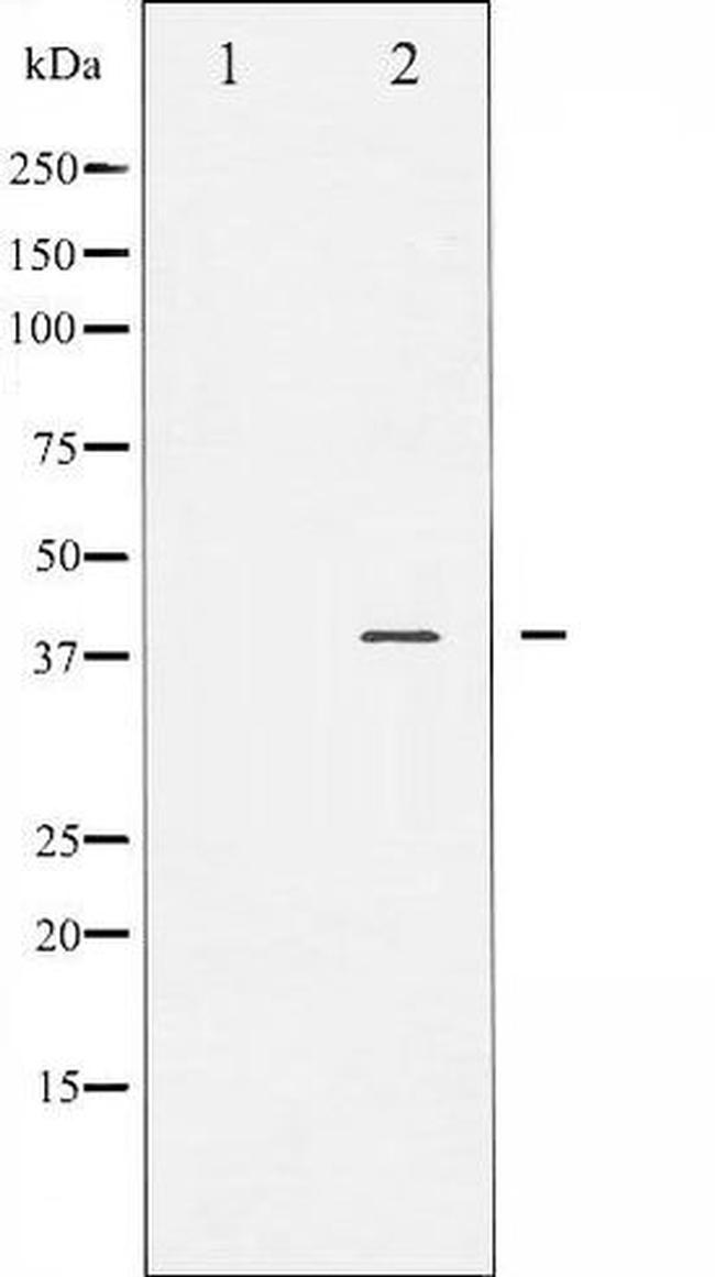 Phospho-JunB (Ser259) Antibody in Western Blot (WB)