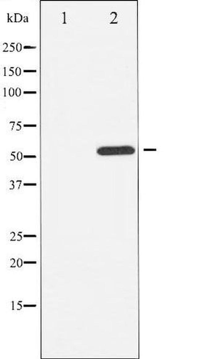 Phospho-ATF2 (Thr69) Antibody in Western Blot (WB)