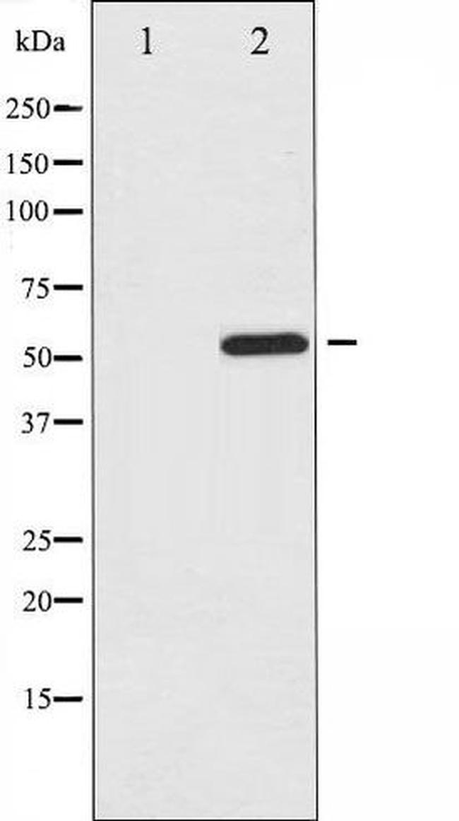 Phospho-ATF2 (Ser112) Antibody in Western Blot (WB)