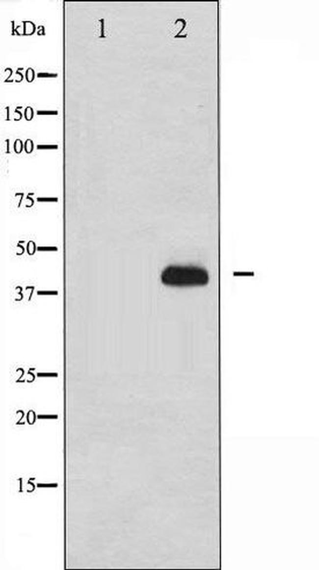 Phospho-NCF1 / p47 phox (Ser359) Antibody in Western Blot (WB)