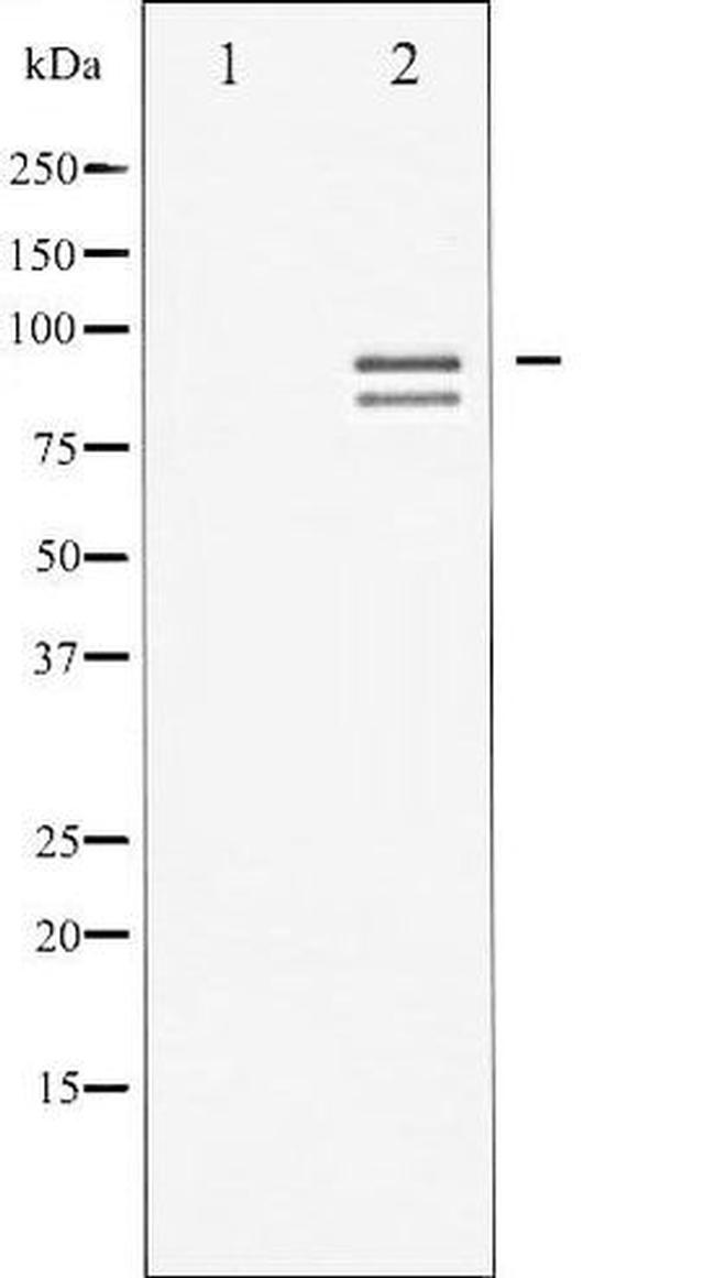Phospho-Glycogen Synthase (Ser645) Antibody in Western Blot (WB)