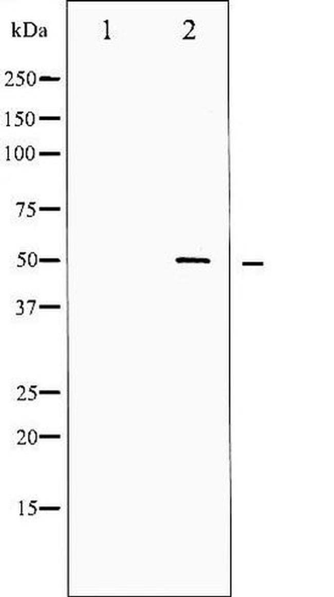 Phospho-SRF (Ser99) Antibody in Western Blot (WB)