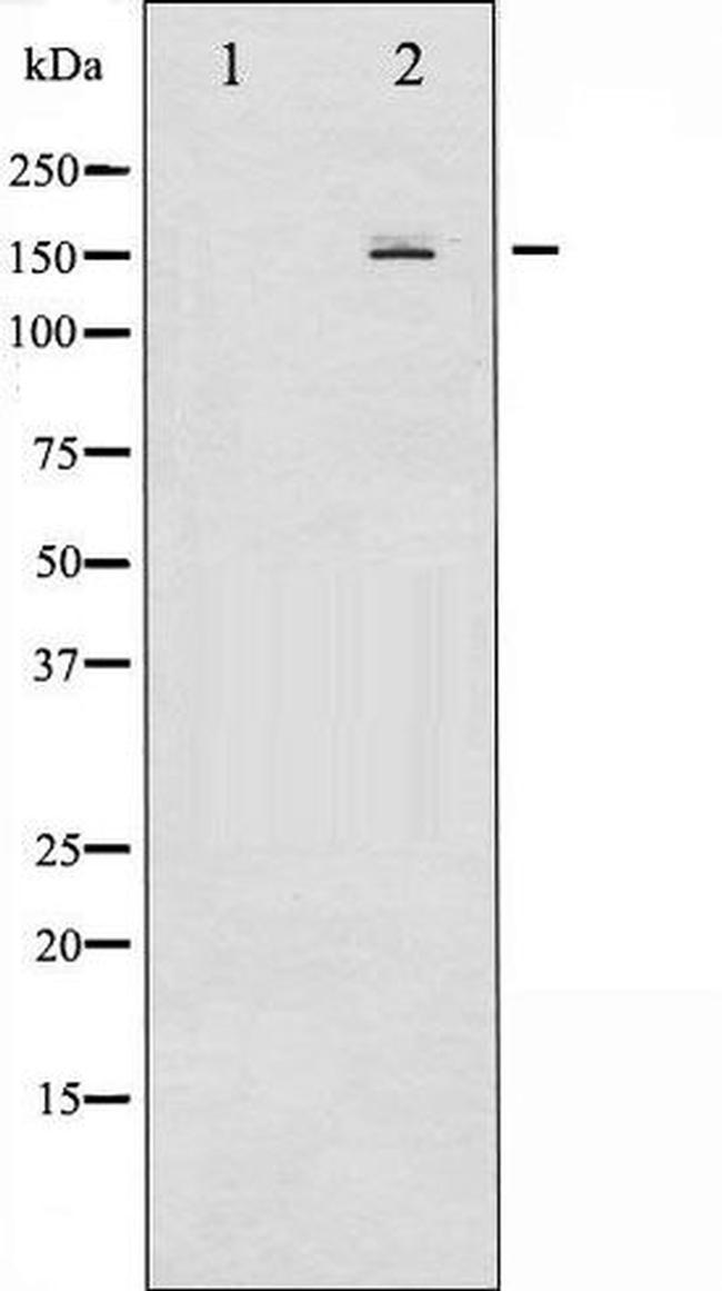 Phospho-PDGF Receptor beta (Tyr740) Antibody in Western Blot (WB)