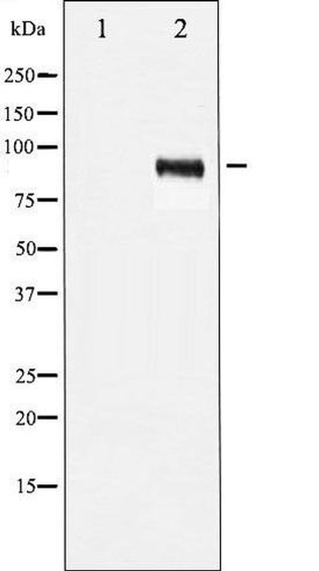 Phospho-IGF1R (Tyr1161) Antibody in Western Blot (WB)