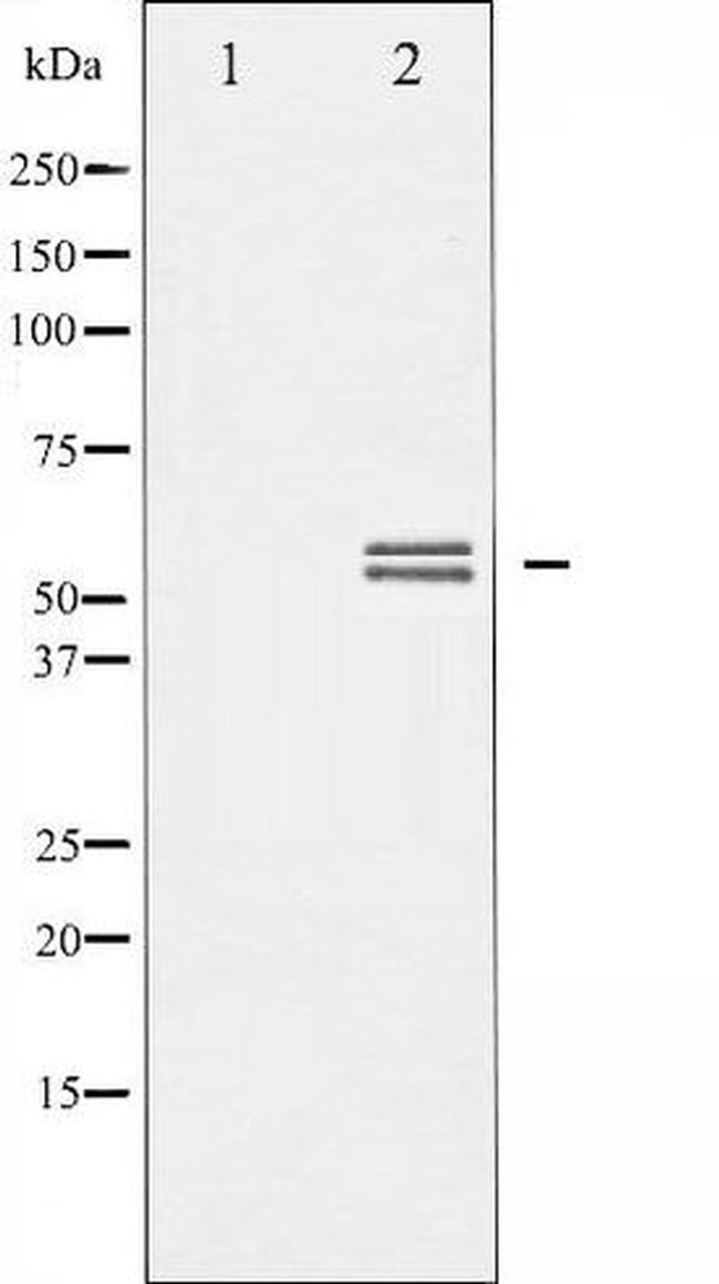 Phospho-Lyn (Tyr507) Antibody in Western Blot (WB)