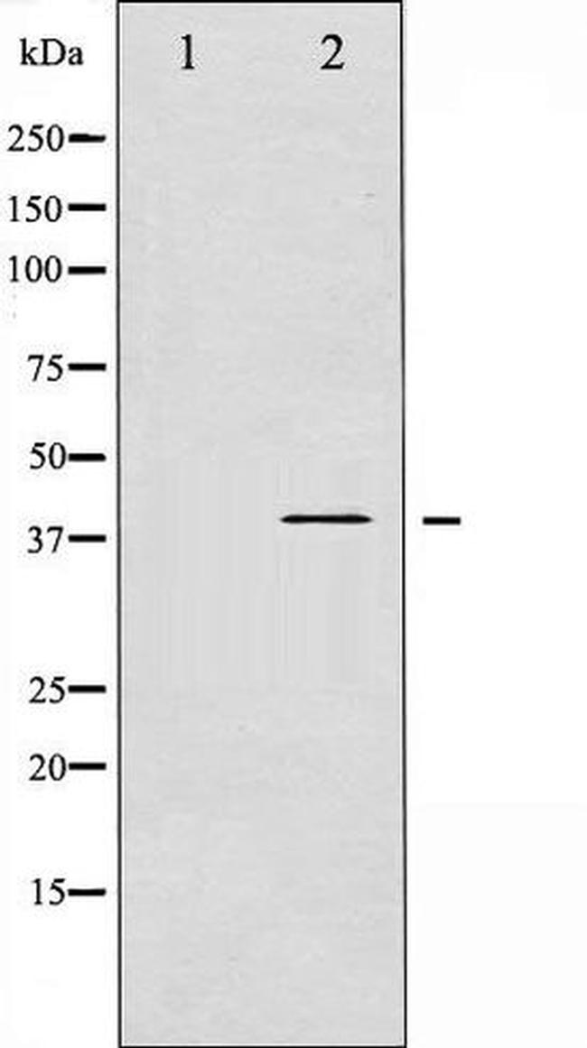 Phospho-beta-2 Adrenergic Receptor (Ser346) Antibody in Western Blot (WB)