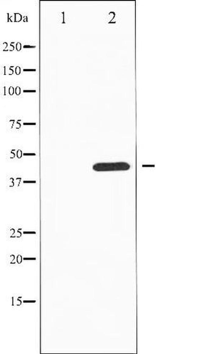 Phospho-Tyrosine Hydroxylase (Ser19) Antibody in Western Blot (WB)