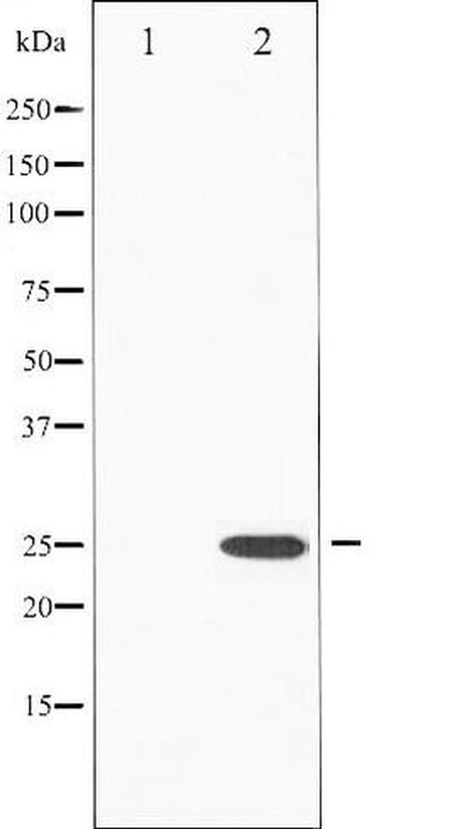 Phospho-EIF4E (Ser209) Antibody in Western Blot (WB)