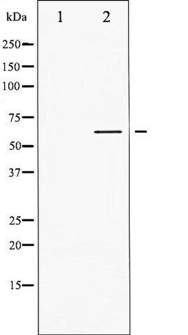 Phospho-Lck (Tyr505) Antibody in Western Blot (WB)