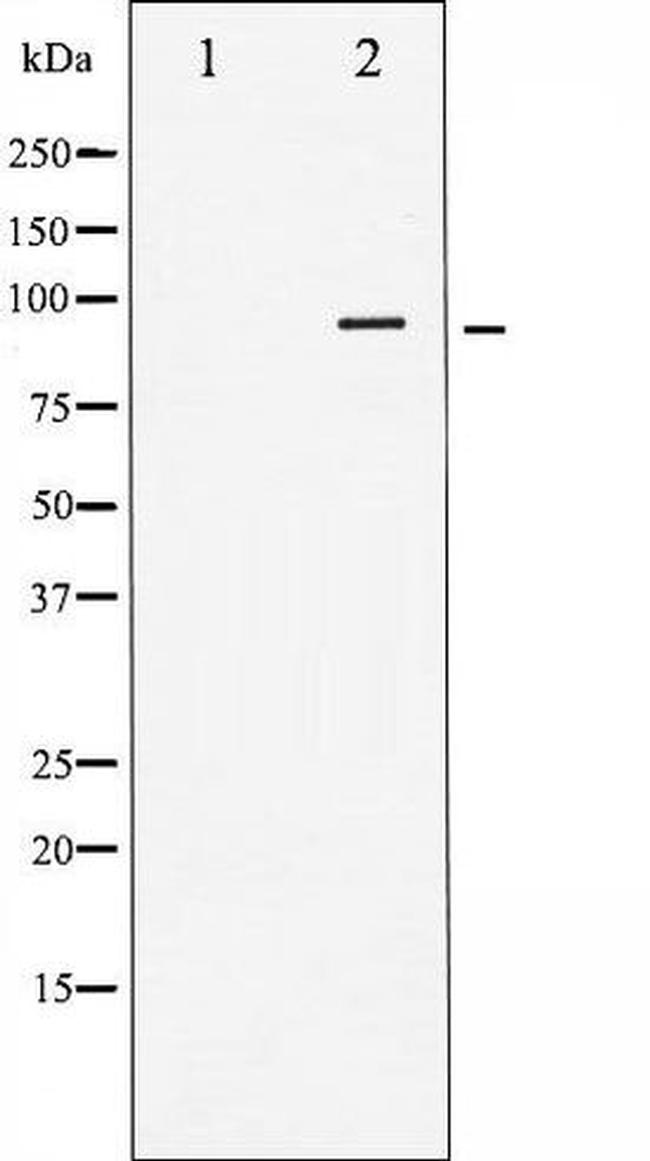 Phospho-IR (Tyr1355) Antibody in Western Blot (WB)