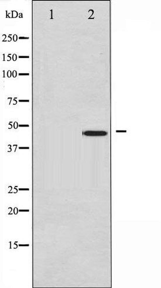 Phospho-c-Jun (Ser73) Antibody in Western Blot (WB)