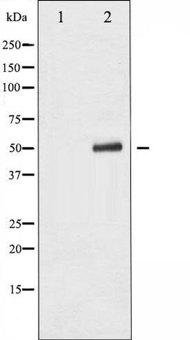 Phospho-p53 (Ser315) Antibody in Western Blot (WB)