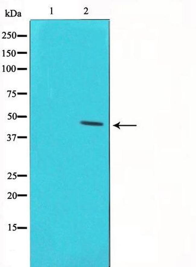 Phospho-p53 (Ser46) Antibody in Western Blot (WB)