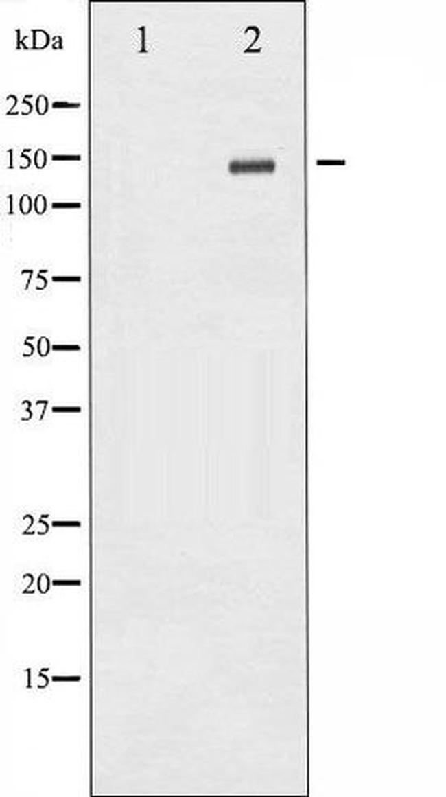 Phospho-ErbB2 (HER-2) (Tyr1112) Antibody in Western Blot (WB)