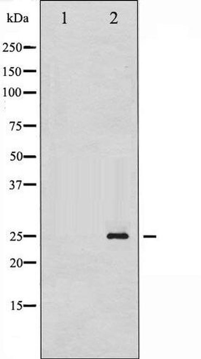 Phospho-Thymidine Kinase 1 (Ser13) Antibody in Western Blot (WB)