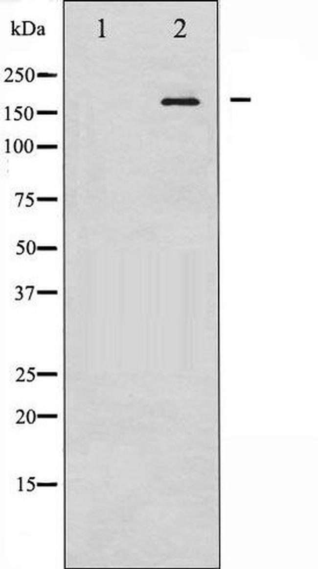 Phospho-EGFR (Tyr1092) Antibody in Western Blot (WB)