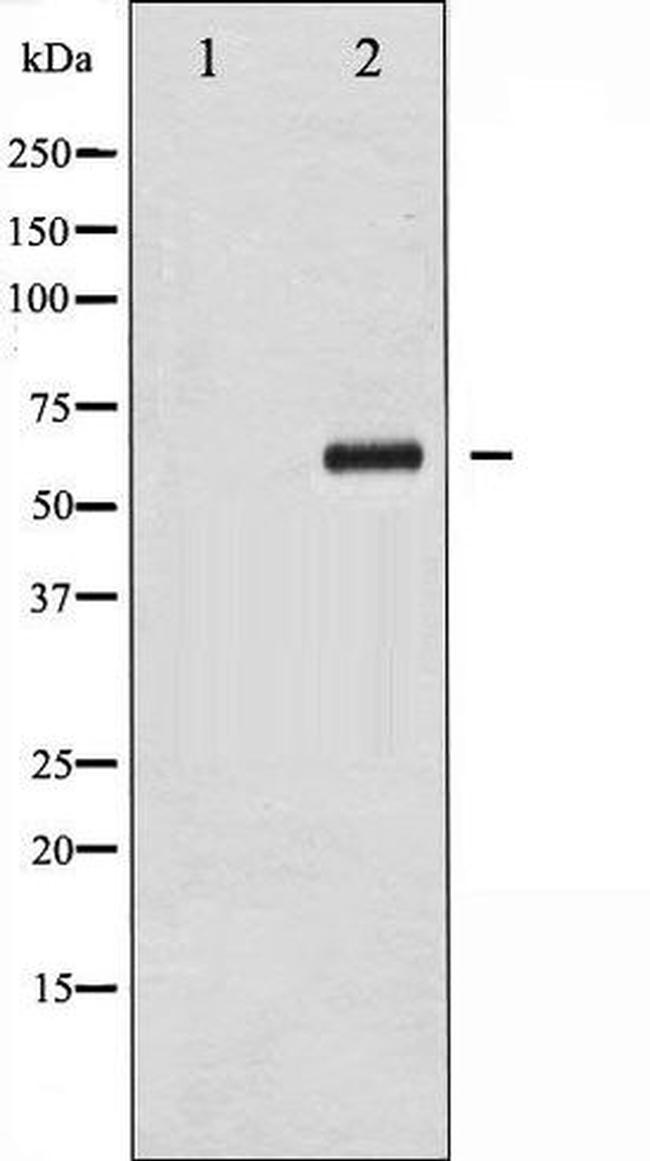 Phospho-Chk2 (Thr383) Antibody in Western Blot (WB)