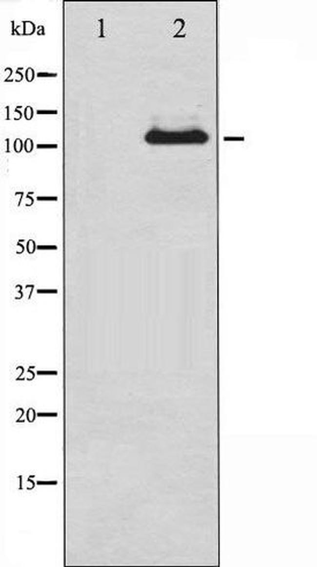 Phospho-JAK2 (Tyr570) Antibody in Western Blot (WB)