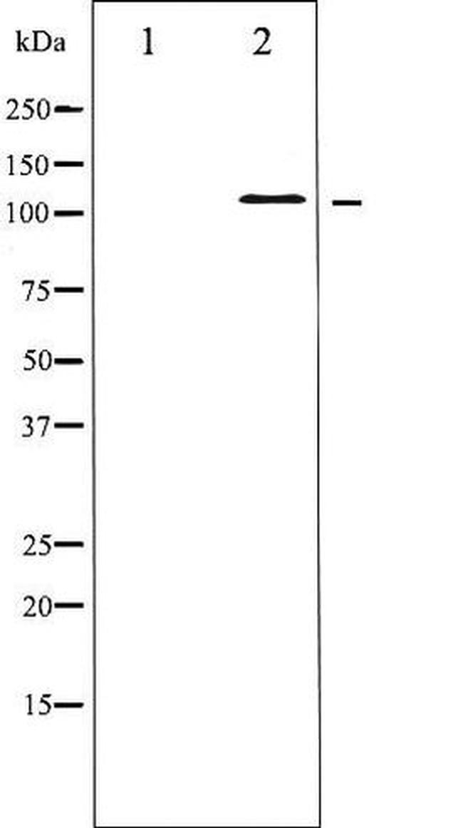 Phospho-JAK2 (Tyr931) Antibody in Western Blot (WB)