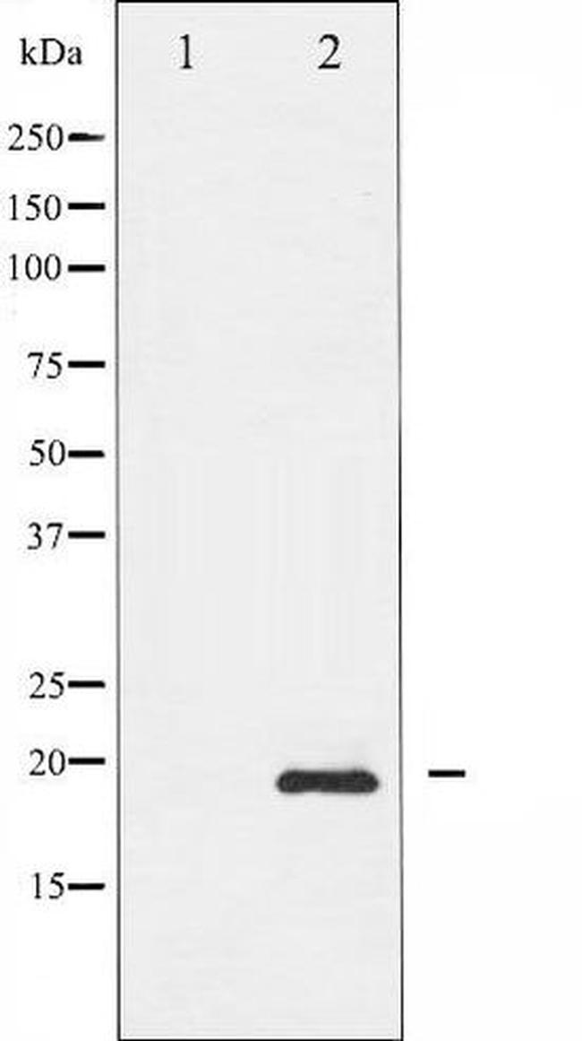 Phospho-Survivin (Thr117) Antibody in Western Blot (WB)