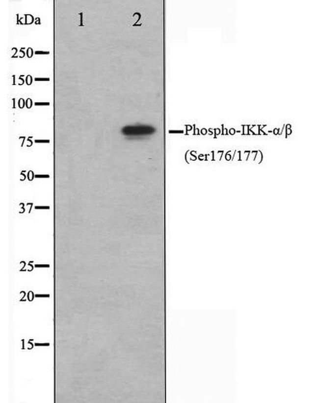 Phospho-IKK alpha/beta (Ser176, Ser177) Antibody in Western Blot (WB)