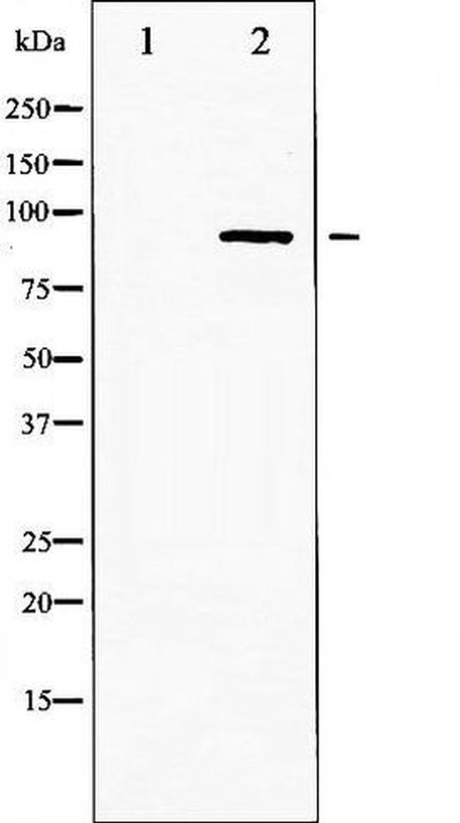 Phospho-IKK alpha/beta (Ser180, Ser181) Antibody in Western Blot (WB)