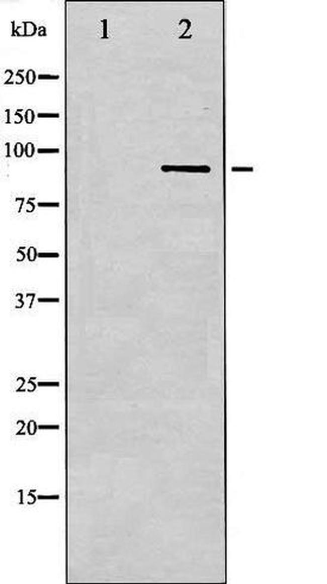 Phospho-IKK-beta (Tyr188) Antibody in Western Blot (WB)
