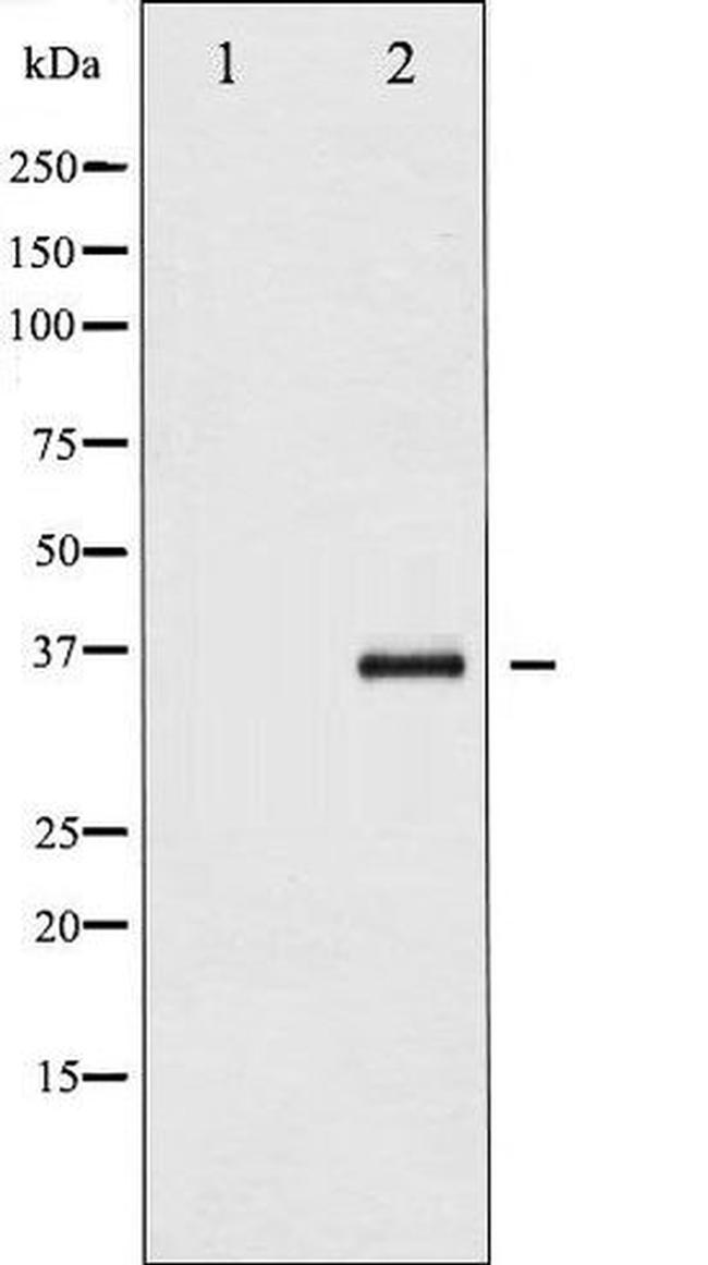 Phospho-I-kappa-B-epsilon (Ser22) Antibody in Western Blot (WB)