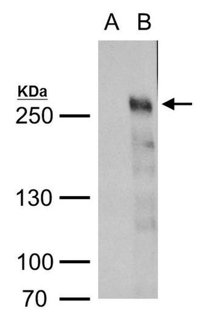 TET2 Antibody in Western Blot (WB)