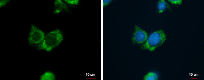 AGMAT Antibody in Immunocytochemistry (ICC/IF)