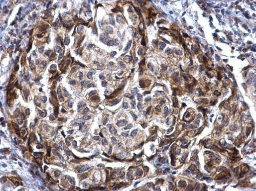 ANKRD35 Antibody in Immunohistochemistry (Paraffin) (IHC (P))
