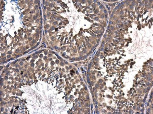 ASZ1 Antibody in Immunohistochemistry (Paraffin) (IHC (P))