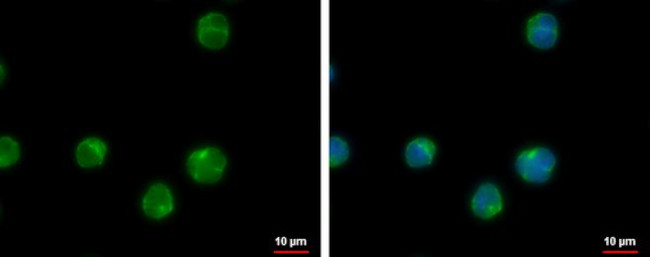 CCDC104 Antibody in Immunocytochemistry (ICC/IF)
